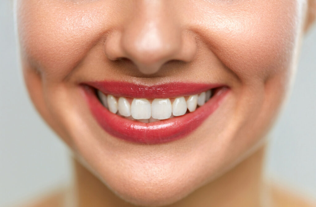 Porcelain Veneers Lansing, MI