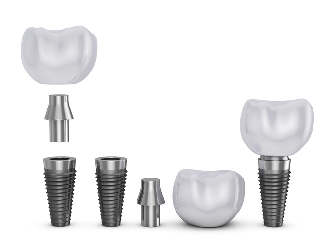 Types of dental implants